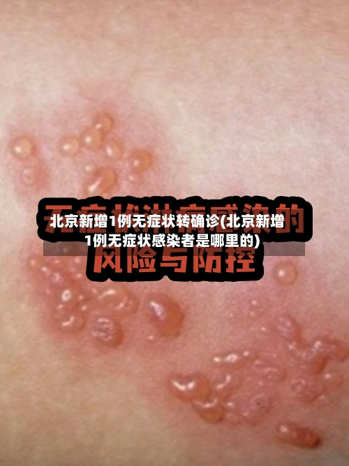 北京新增1例无症状转确诊(北京新增1例无症状感染者是哪里的)-第2张图片