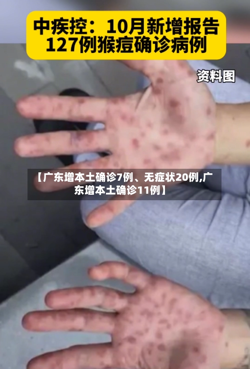 【广东增本土确诊7例、无症状20例,广东增本土确诊11例】-第3张图片