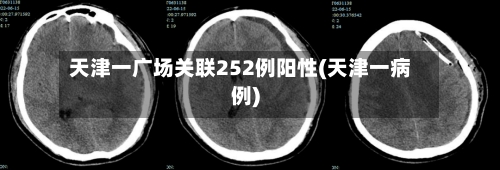 天津一广场关联252例阳性(天津一病例)-第1张图片