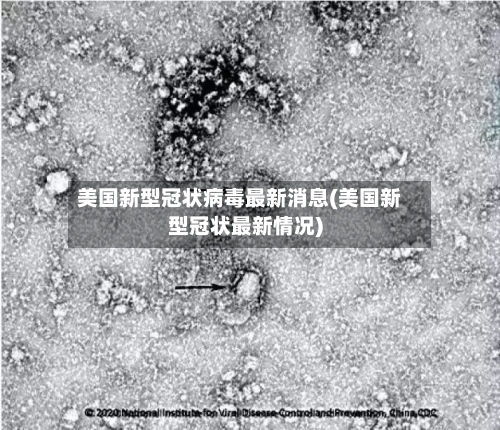 美国新型冠状病毒最新消息(美国新型冠状最新情况)-第2张图片
